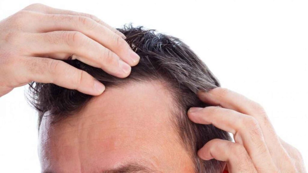 keratina causa caida cabello